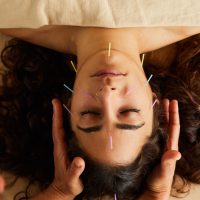 acupuncture rajeunissant (aculifting)