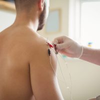 dry needling électro
